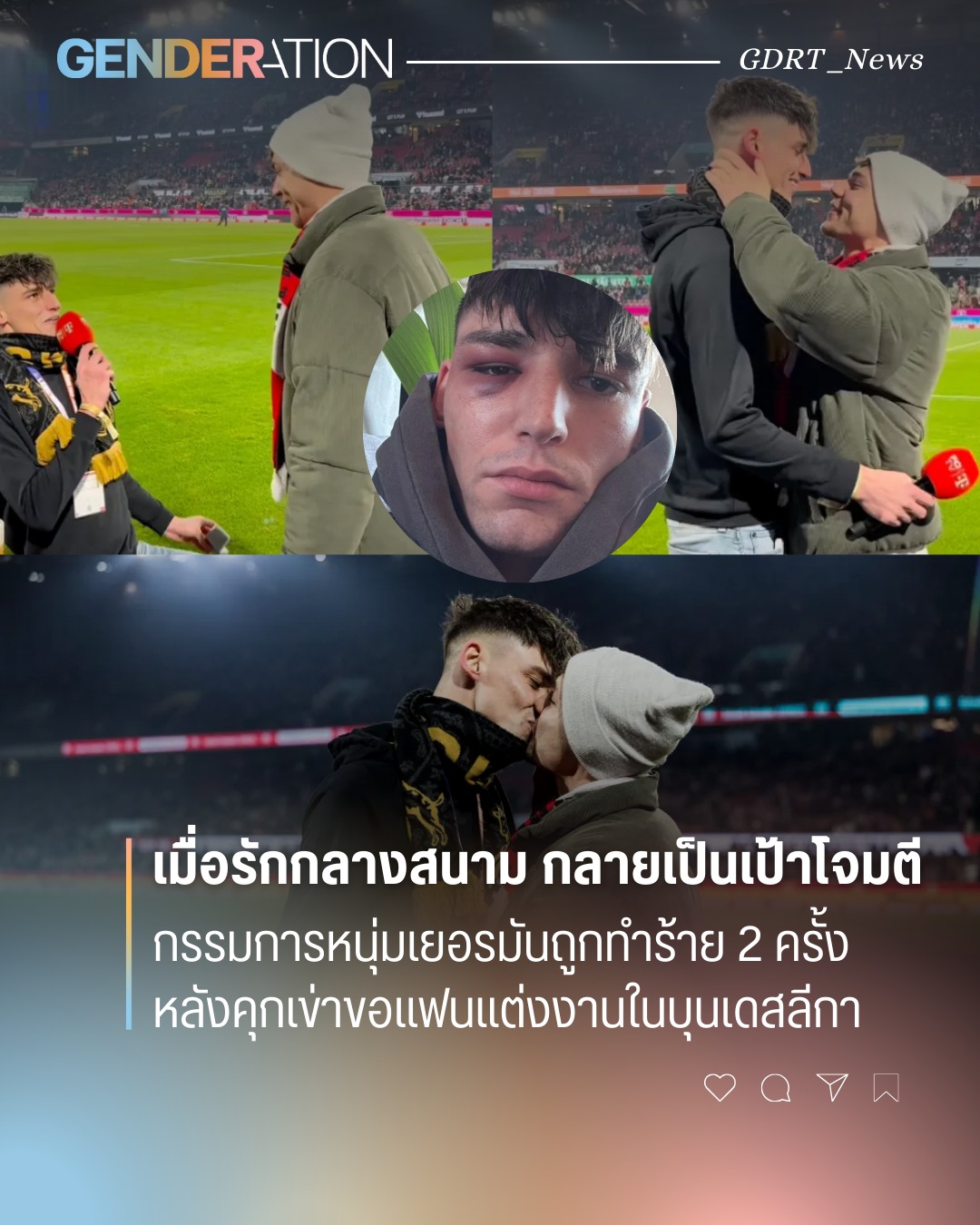 หนุ่มเยอรมันถูกทำร้าย 2 ครั้งหลังคุกเข่าขอแฟนแต่งงานกลางสนามบุนเดสลีกา